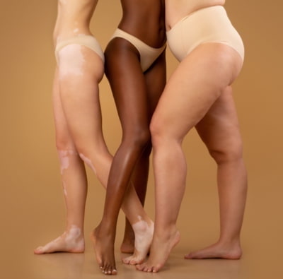womens legs