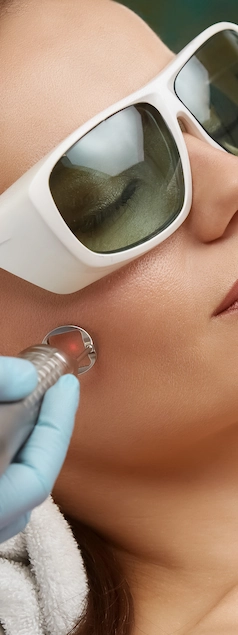 laser treatment on the face to improve skin tone and texture