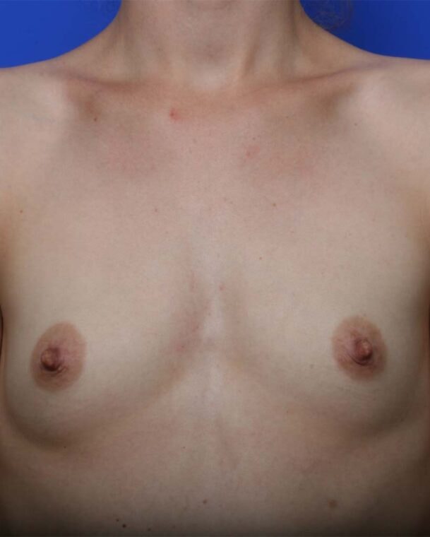 before image