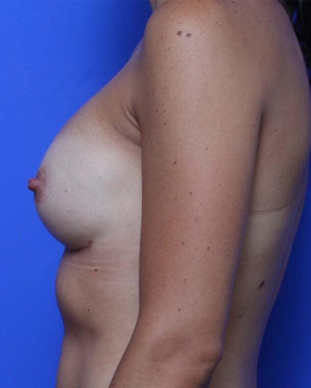 after image