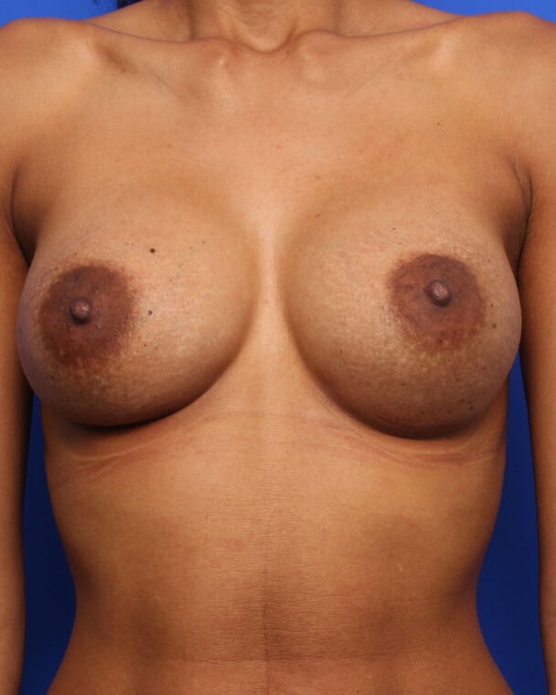 after image