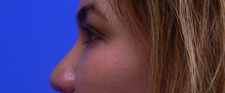 after image