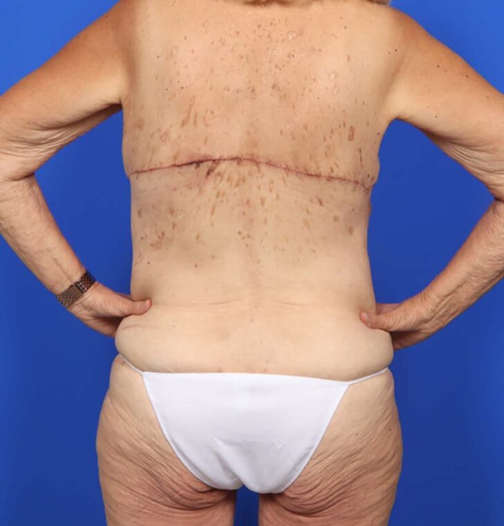 after image