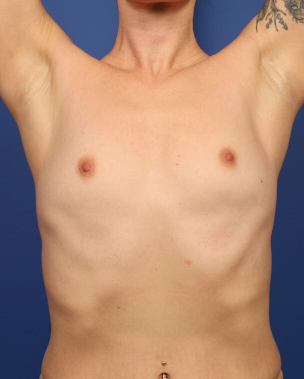 before image