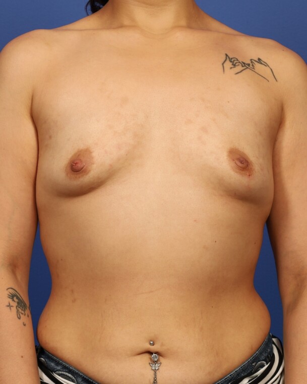 before image