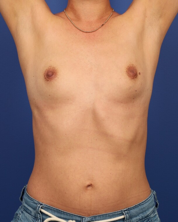 before image