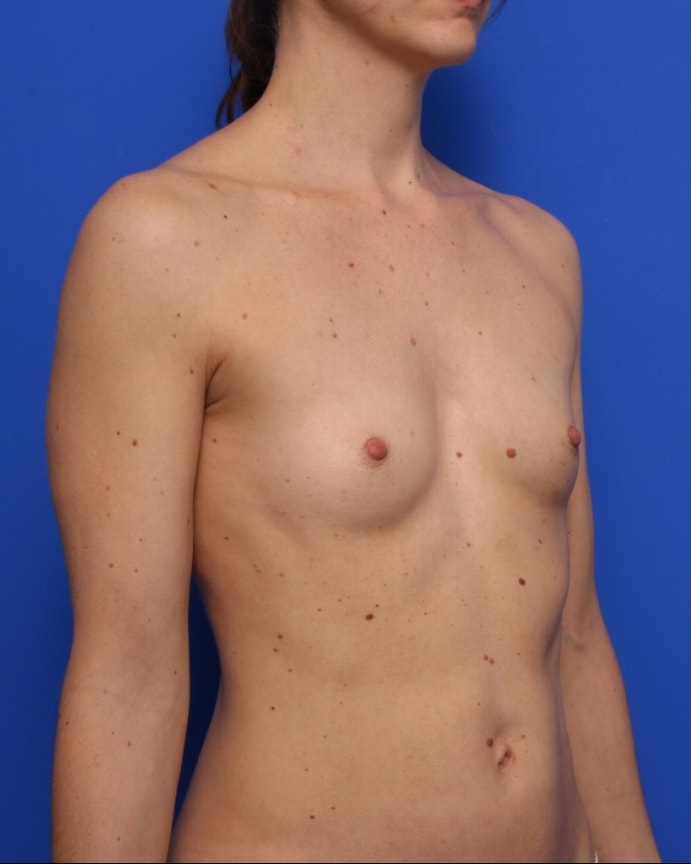 bna image