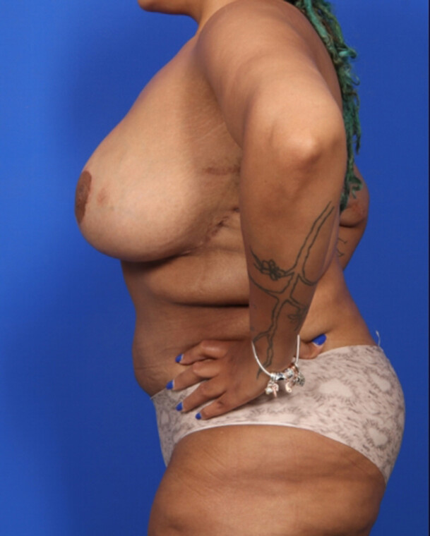 after image