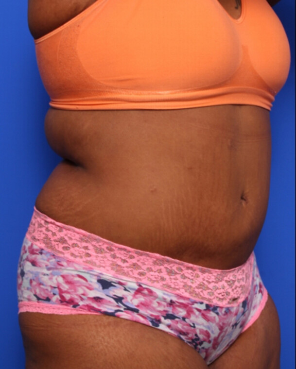 after image