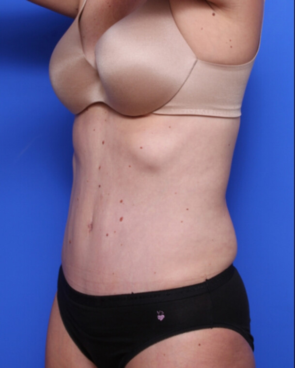 after image