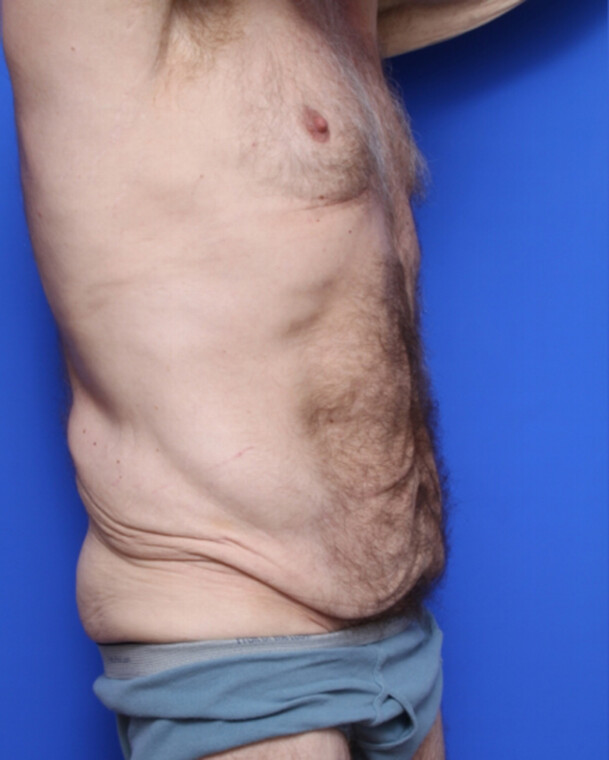 before image