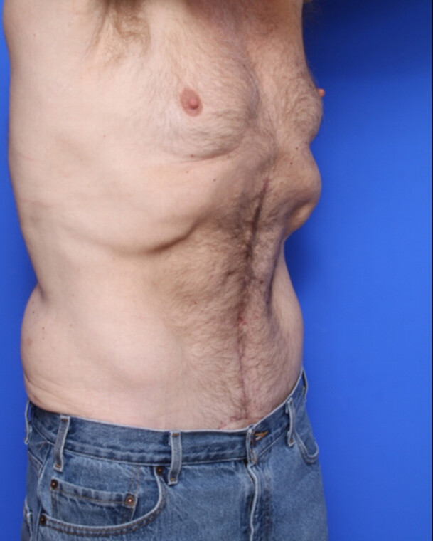 after image