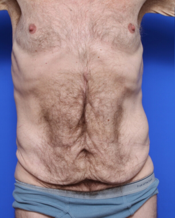 before image
