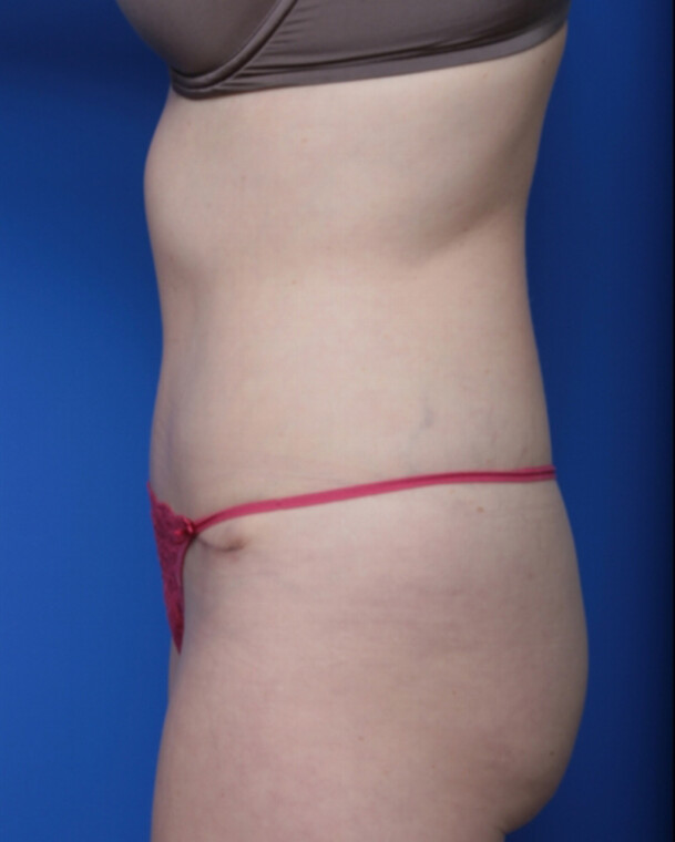 after image