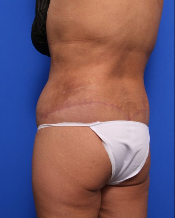 after image