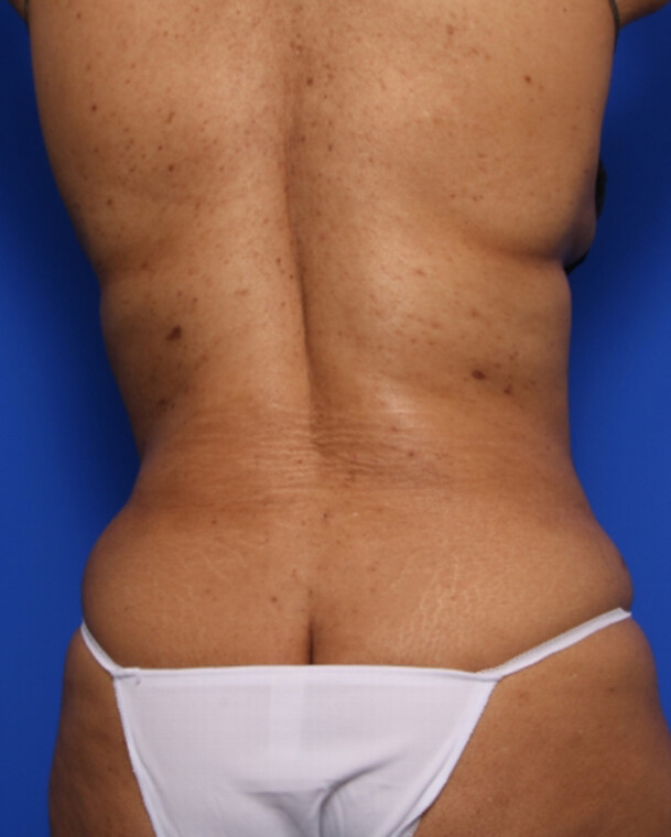 after image