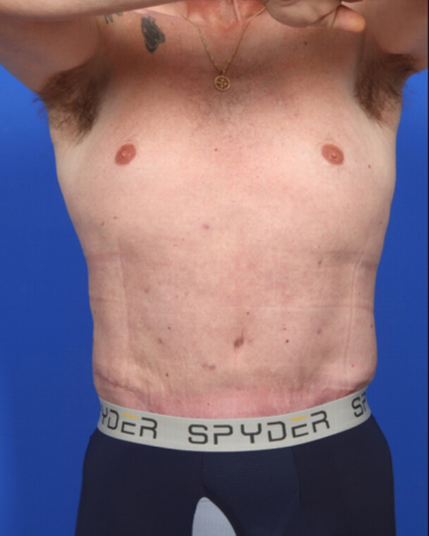 after image