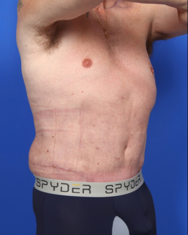 after image