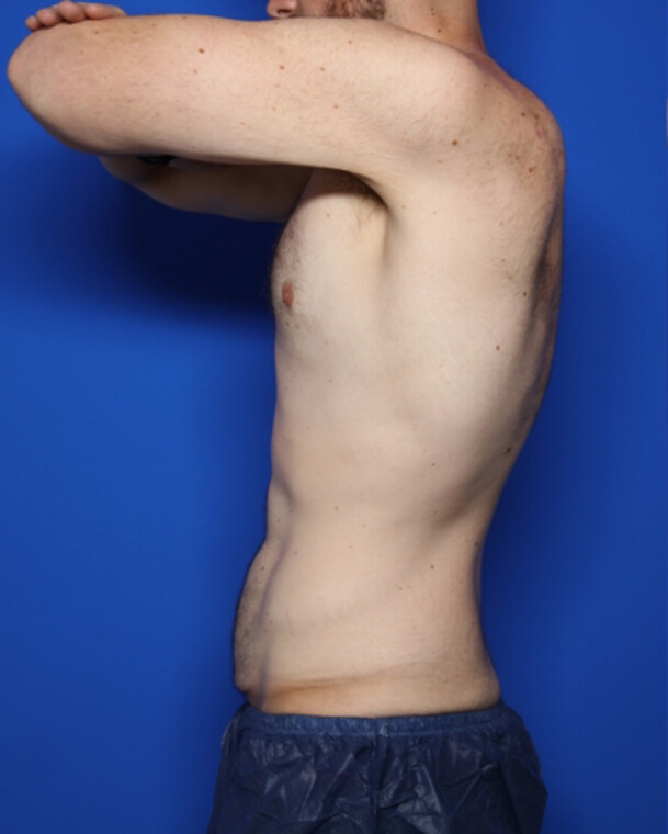 before image