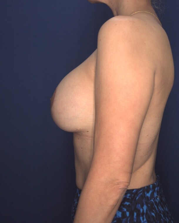after image