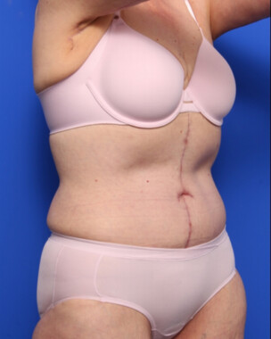 Case # 7 after photo