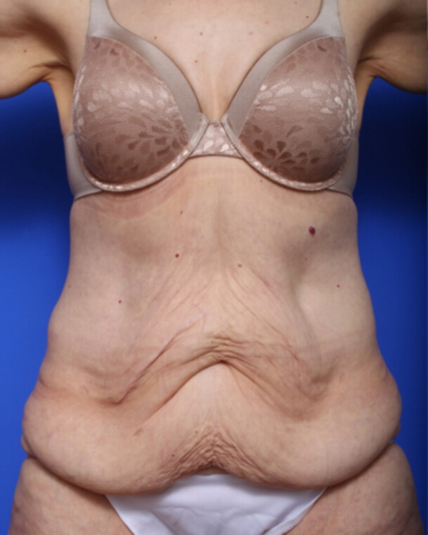 before image