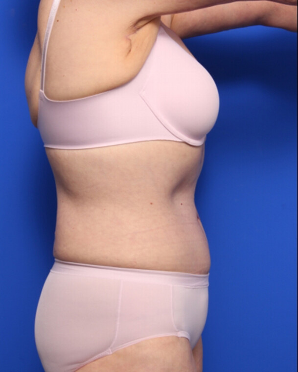 after image