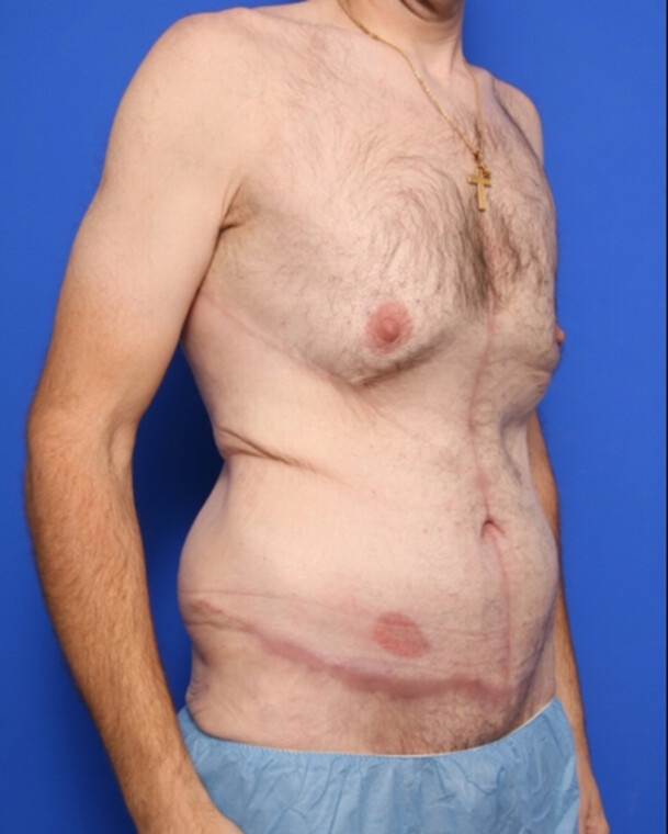 after image