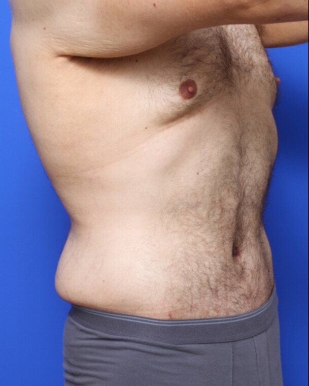 after image