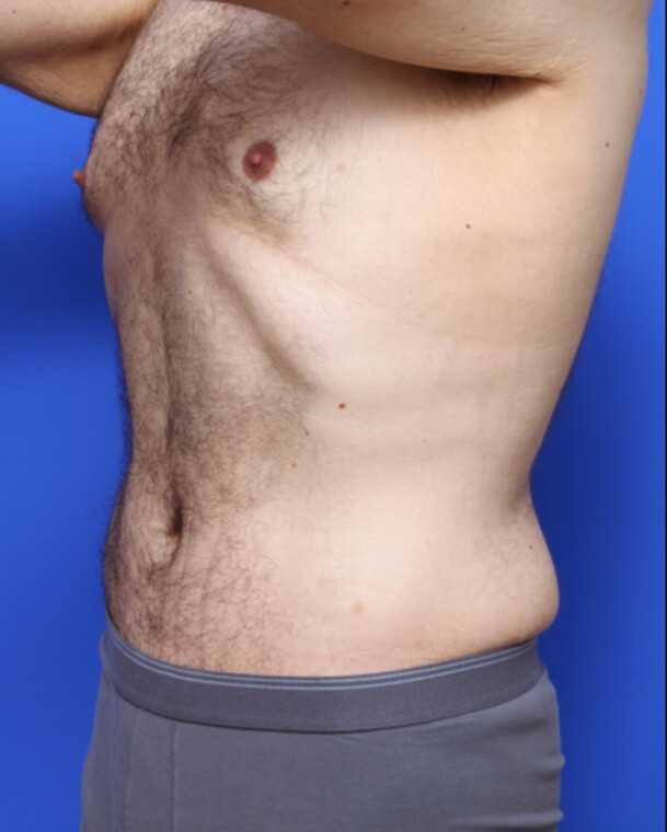 after image