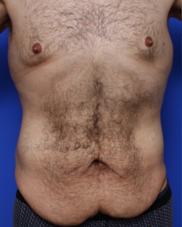 before image