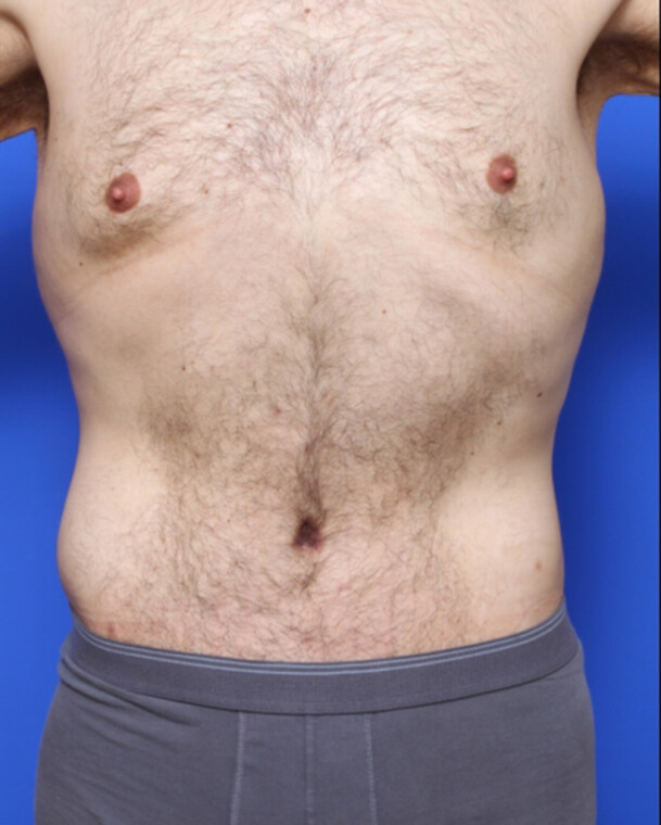 after image