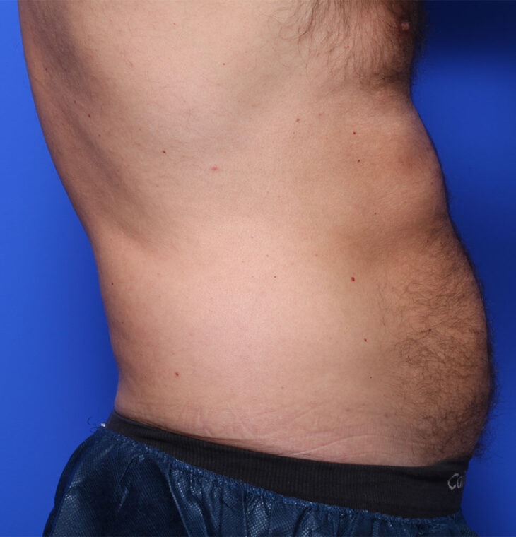before image