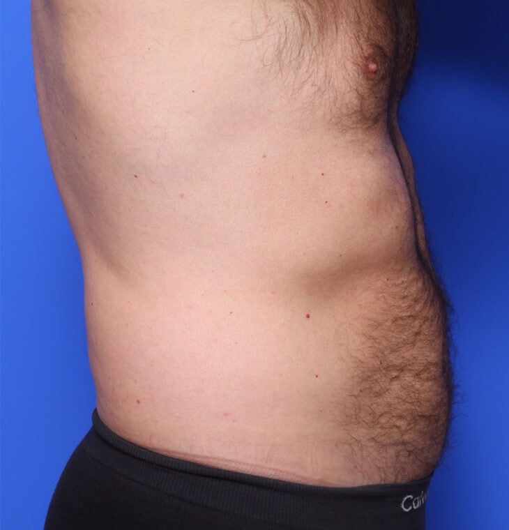 after image