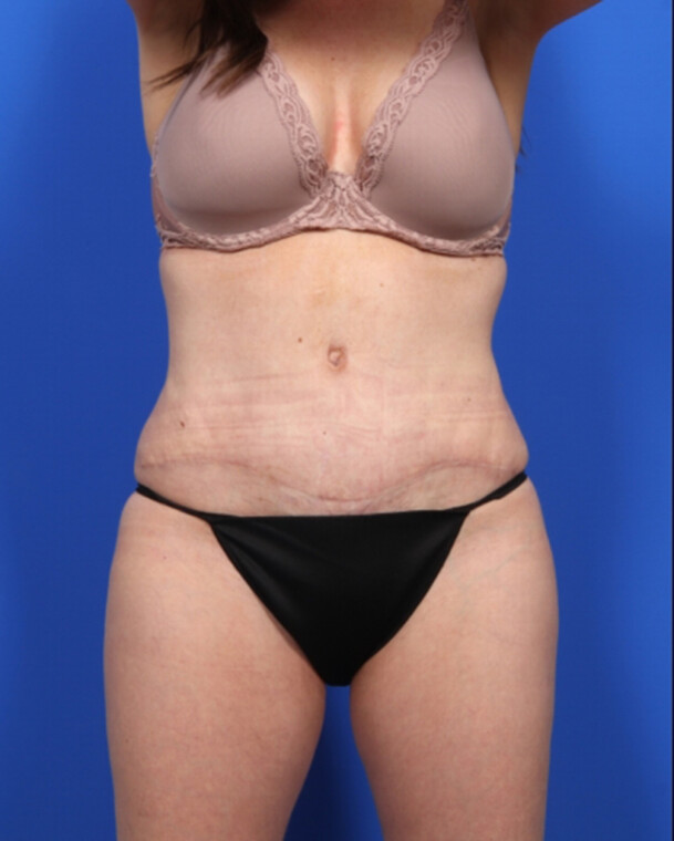 after image