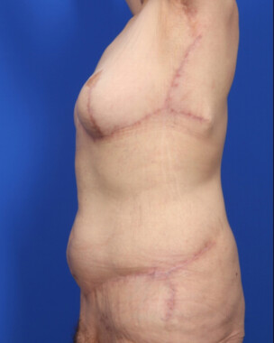 Case # 15 after photo