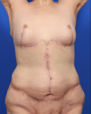 Case # 15 after photo