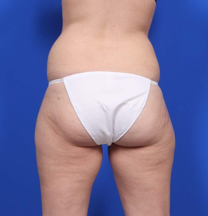 after image