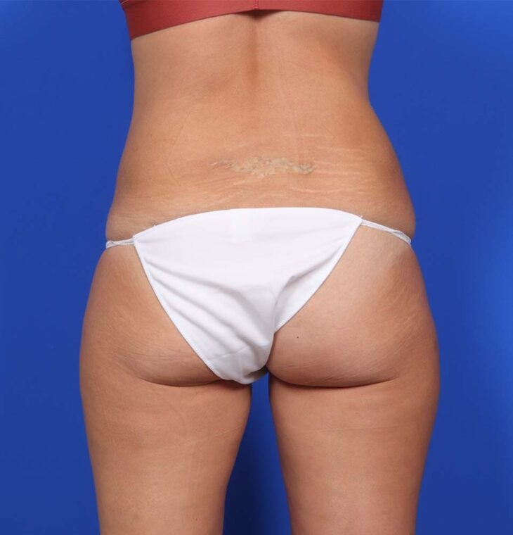 after image