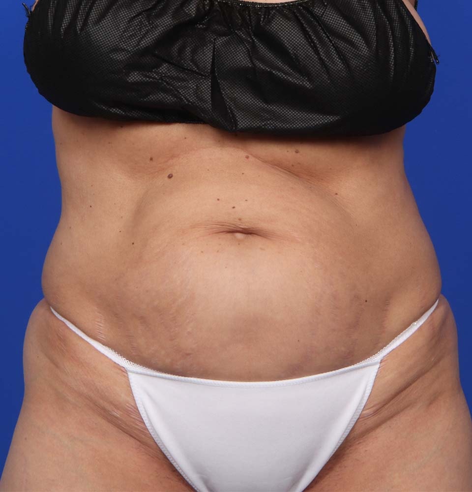 bna image
