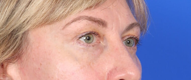 after image