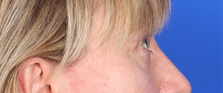 after image