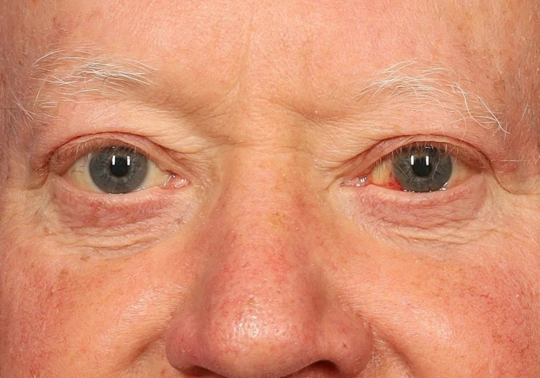 after image