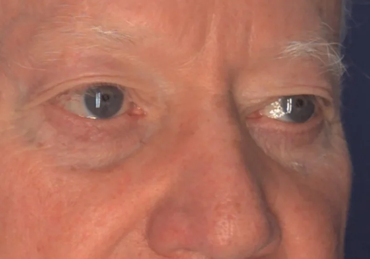 before image