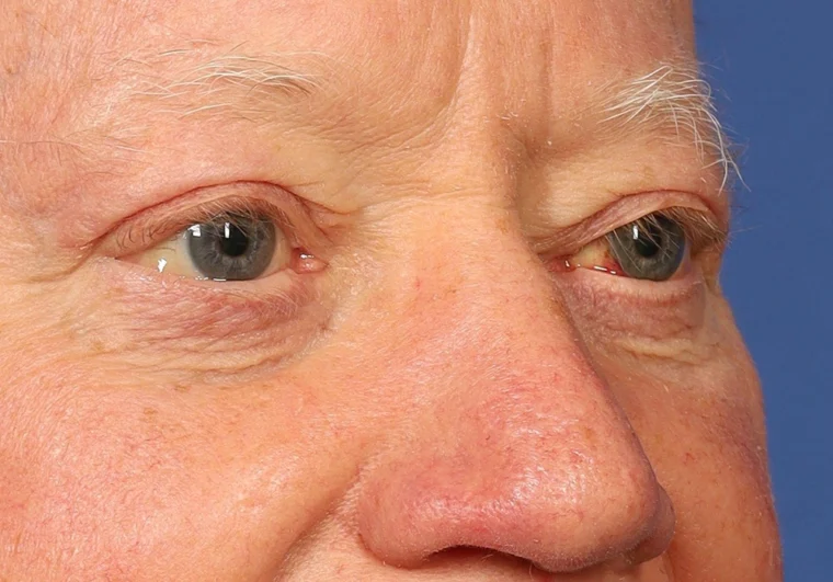 after image