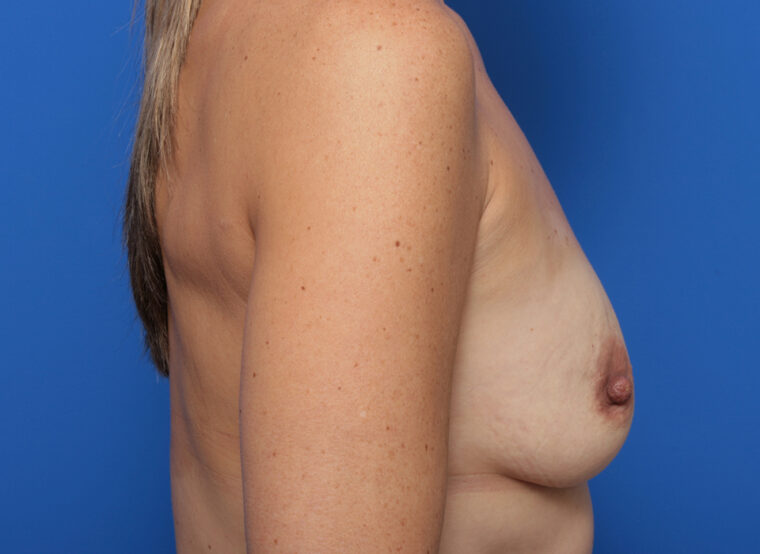 bna image
