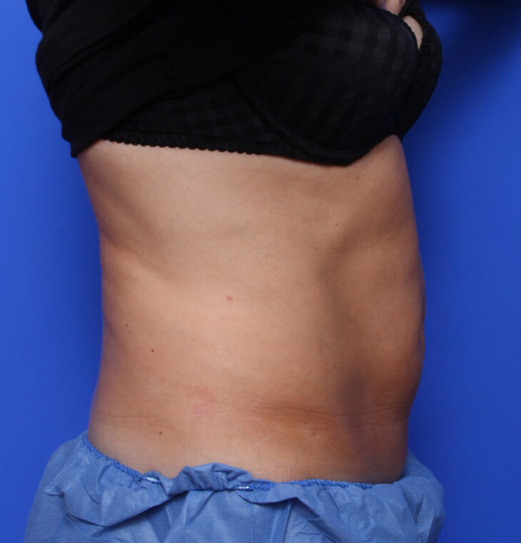 after image