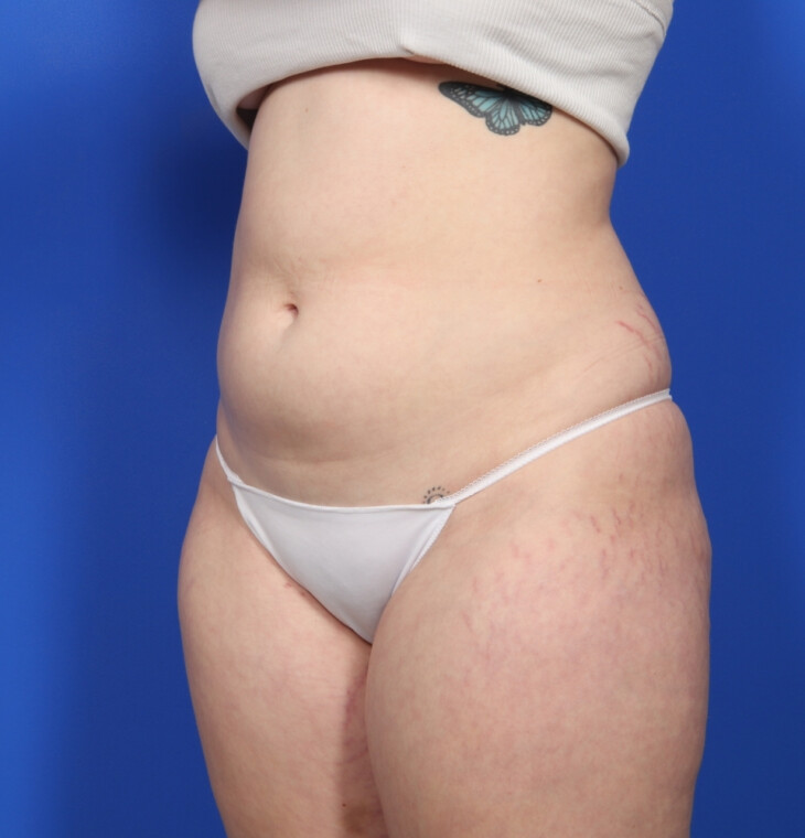 before image