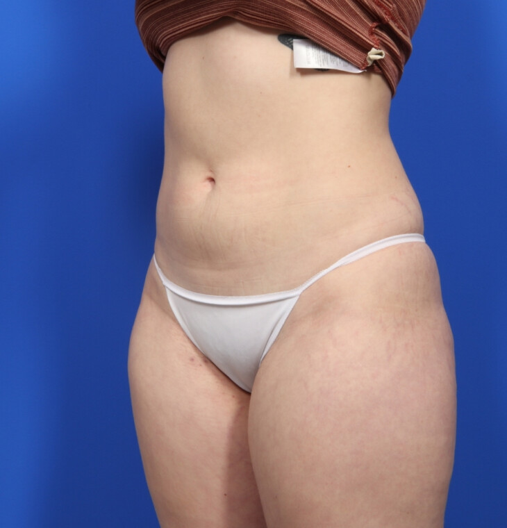 after image