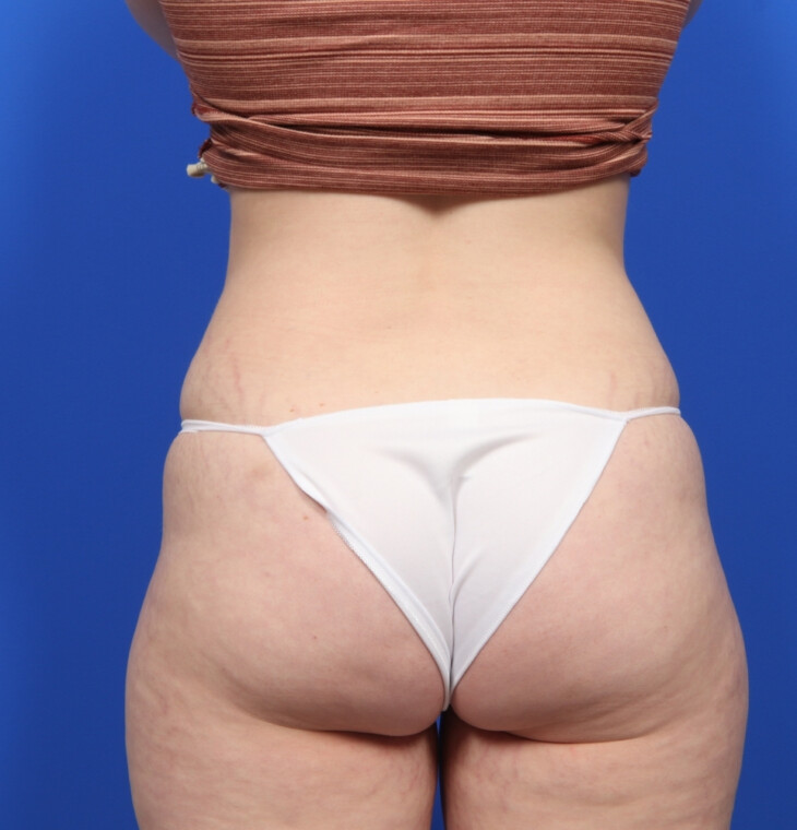 after image